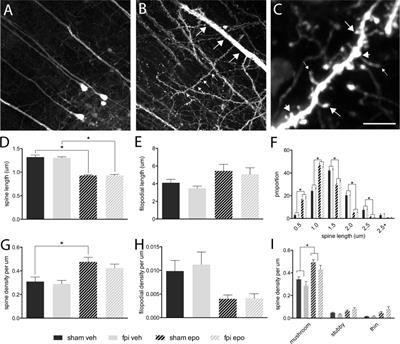 The Microtubule-Modulating Drug Epothilone D Alters Dendritic Spine Morphology in a Mouse Model of Mild Traumatic Brain Injury